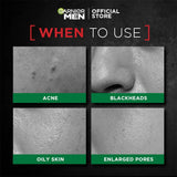 Garnier Men Acno Fight XL Tissue Mask Men, 5X Salicylic Acid and Charcoal Powder, Fight Pimple causing Germs in 5 min, Suitable for all Skin types, 22g