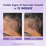 Bare Anatomy Nature x Science Rosemary Hibiscus Hair Growth Oil for Women & Men (100ml)