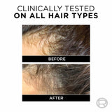 LOreal Paris Fall Repair 3X Anti-Hair Fall Conditioner (180ml)