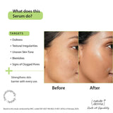 Nature Derma 10% Niacinamide & Zinc Serum with Natural Biome-Boost™ | Reduces Pores and Dark spots (30ml)