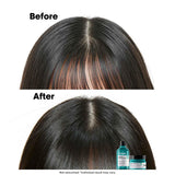 L'Oreal Professionnel Serie Expert Scalp Advanced Shampoo (300ml)