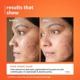 plamserum - Plum 10% Vitamin C & Calendula Barrier Boosting + Glow Serum | Boosts glow from 1st use | Ceramides strengthens skin barrier | Niacinamide fights pigmentation & dark spots | Non - irritant| Men & Women | For all skin types | 30ml - Looknstyle