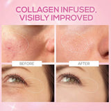 RENEE Pink Therapy Hydrolyzed Collagen Sleep Jelly Cream | Hydrates, Repairs, Smoothens & Plumps Skin | Peptides, Niacinamide & Hydrolyzed Collagen Enriched | 50 gm