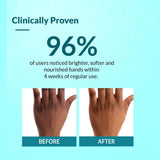 Fixderma Brightening Hand Cream for Women & Men | Hand Moisturizer | Kojic Acid Cream | Hand Cream for Dry and Rough Hands | Cream for Itchy Hand | Hand Cream with SPF 50 | All Skins Types - 30gm