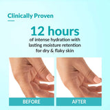 Fixderma Moisturizing cream, Daily Moisturizer for Dry & chapped skin, Provides Hydration and Moisturization, Non-Comedogenic & Non-Greasy formulation, 60g