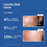 Plum 10% Niacinamide & Rice Water Face Serum For Clear, Bright Skin | Fades Blemishes & Acne Marks| Lightweight & Quick-absorbing| Dermatologically Tested | All Skin Types | Women & Men | Fragrance-Free | 100% Vegan | 50ml