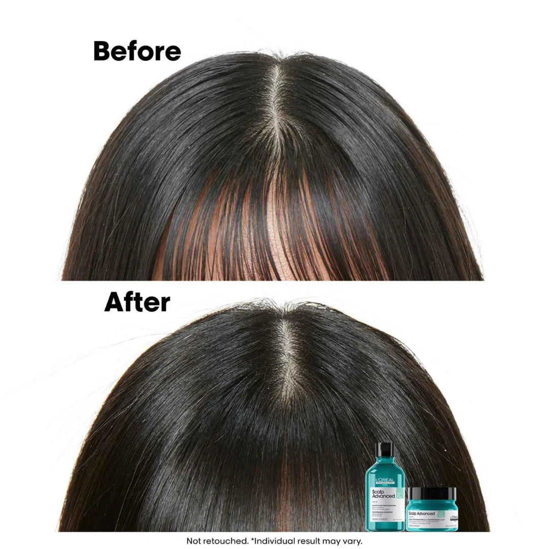L'Oreal Professionnel Serie Expert Scalp  Advanced Shampoo (300ml)