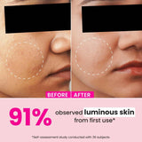 dotwatermel - Dot & Key Watermelon 10% Glycolic Serum for Face Glowing,20 ml - Looknstyle