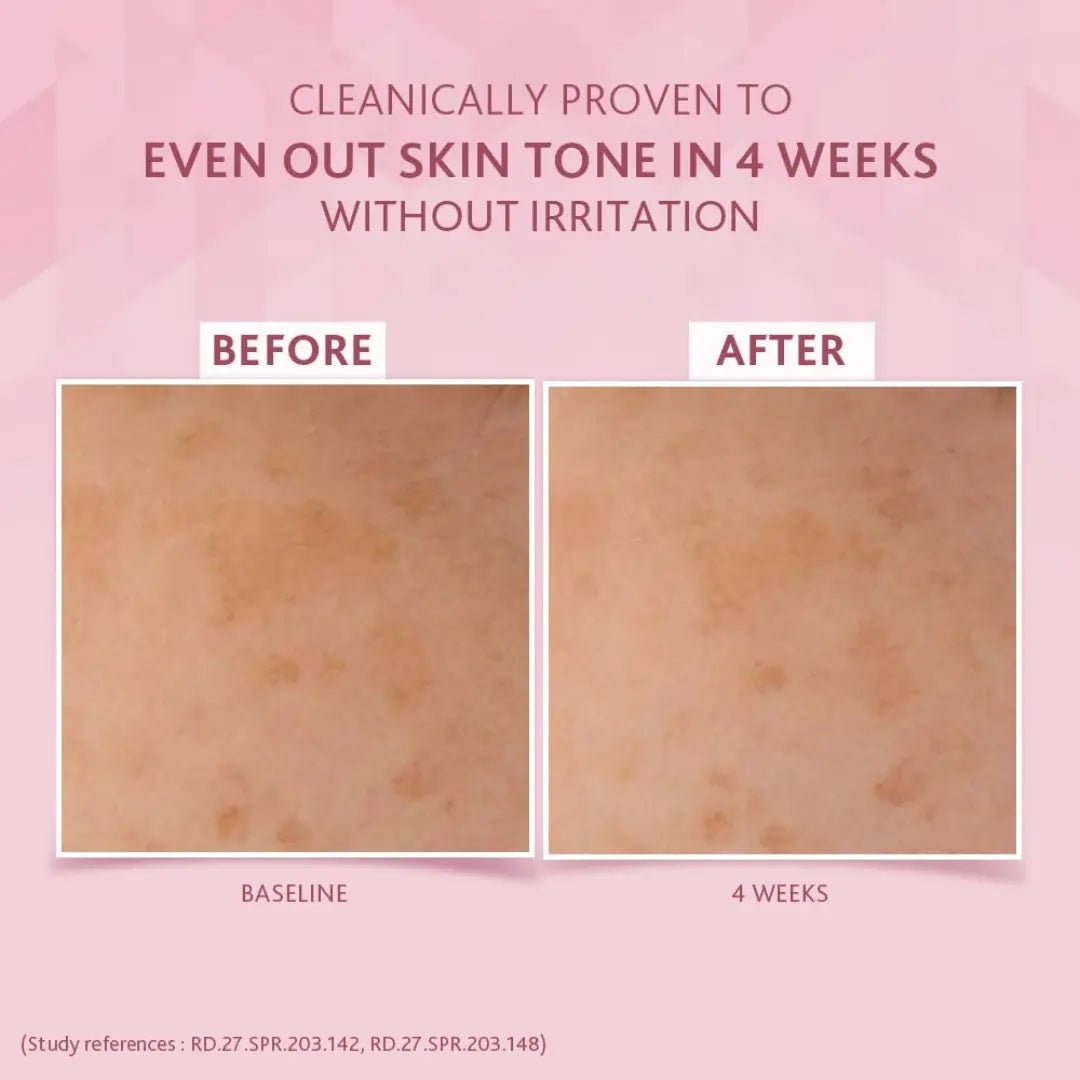 ctphlbhrngtcrm50 - Cetaphil Bright Healthy Radiance Brightening Night Comfort Cream (50g) - Looknstyle