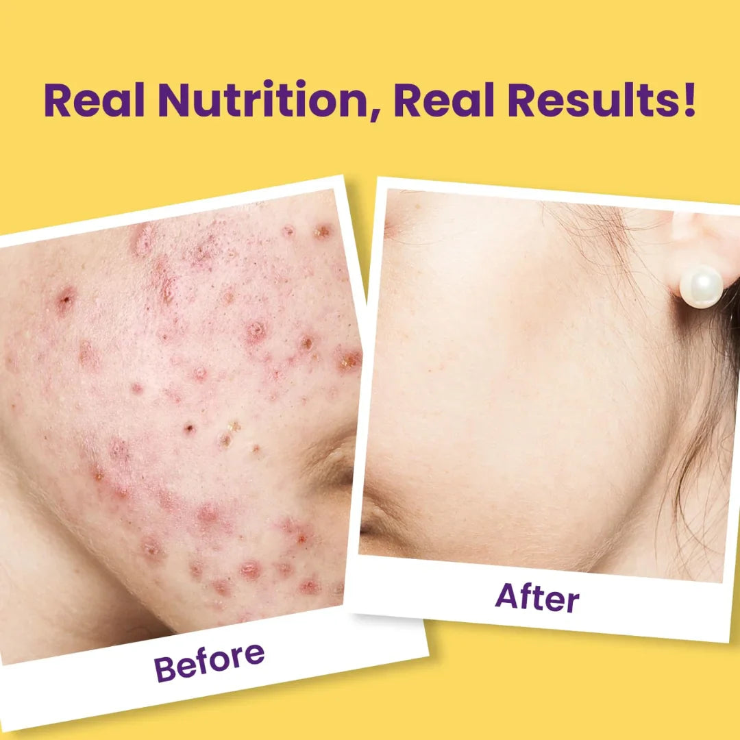 Chicnutrix Super C - Natural Vitamin C & Zinc for Clear & Acne Free Skin | 1000mg Amla Extracts (pack of 2)