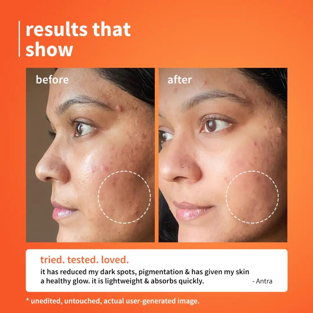 Plum 10% Vitamin C & Calendula Barrier Boosting + Glow Serum | Boosts glow from 1st use | Ceramides strengthens skin barrier | Niacinamide fights pigmentation & dark spots | Non-irritant| Men & Women | For all skin types | 30ml