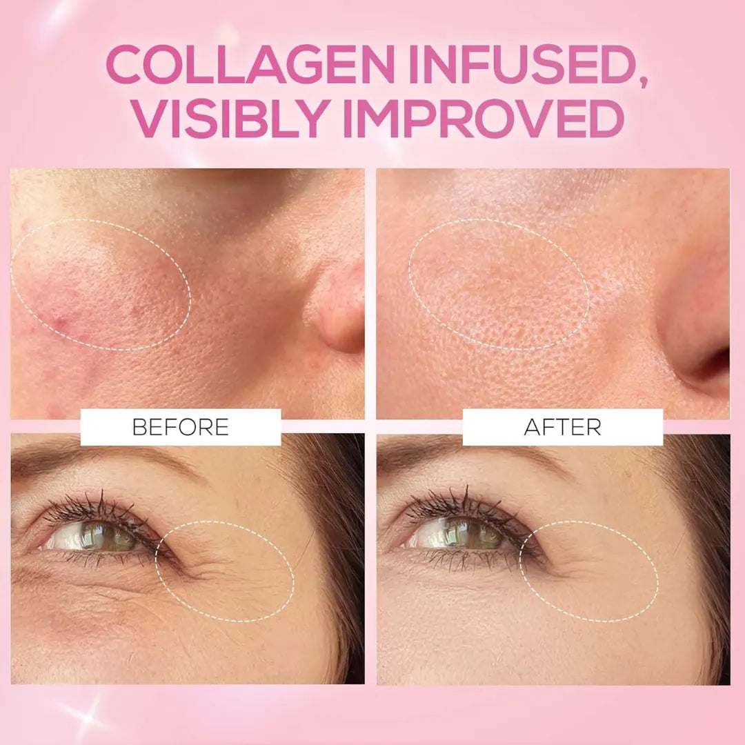 RENEE Pink Therapy Hydrolyzed Collagen Sleep Jelly Cream | Hydrates, Repairs, Smoothens & Plumps Skin | Peptides, Niacinamide & Hydrolyzed Collagen Enriched | 50 gm