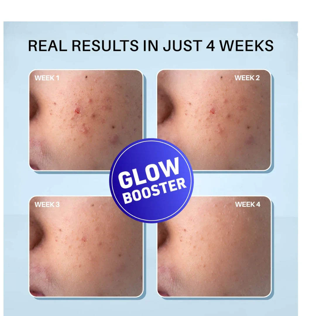 DERMDOC 2% Kojic Acid Glow Fusion Formula Night Cream with Niacinamide & Alpha Arbutin for Skin Brightening (50 gm) | Face Cream I Night Cream I Kojic Acid Brightening Cream I Glowing Skin
