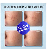 DERMDOC 2% Kojic Acid Glow Fusion Formula Night Cream with Niacinamide & Alpha Arbutin for Skin Brightening (50 gm) | Face Cream I Night Cream I Kojic Acid Brightening Cream I Glowing Skin