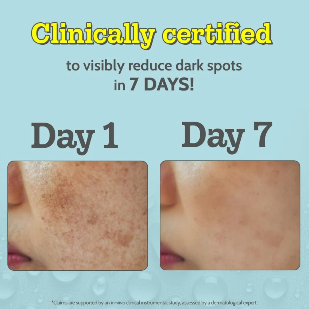 Chemist At Play 10% Vitamin C Face Serum| Brightens & Gives Glow |Fades Dark Spots |Treats Hyperpigmentation | For All Skin Types (30ml)
