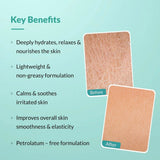 Fixderma Dewrav Moisturizing Cream for Face & Body with Magnesium Oil & Shea Butter | Deeply Moisturize, Hydrates & Soften Skin | Soothes Irritation | For Dry to Very Dry Skin - 250g - Deals999