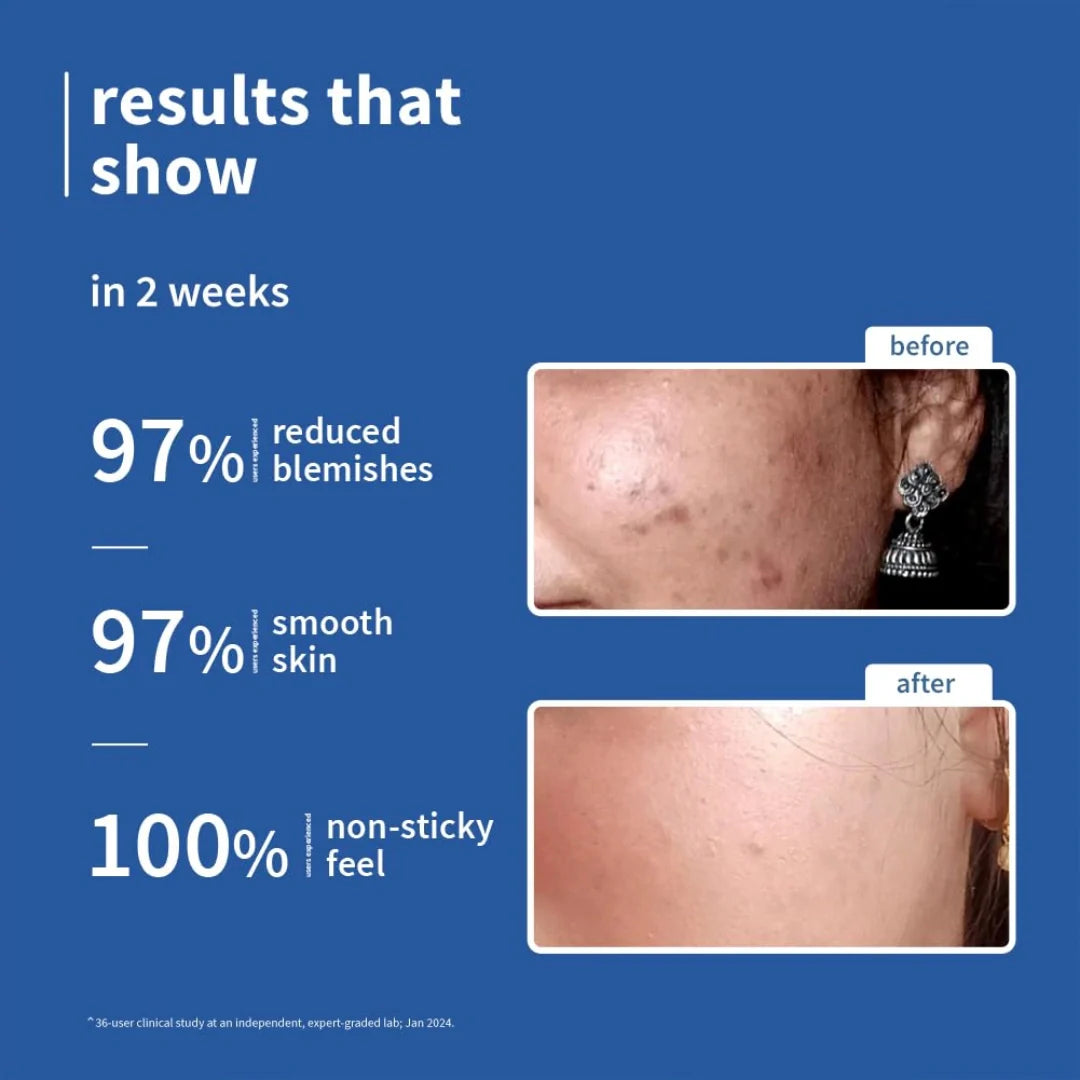 Plum 10% Niacinamide & Rice Water Face Serum For Clear, Bright Skin | Fades Blemishes & Acne Marks| Lightweight & Quick-absorbing| Dermatologically Tested | All Skin Types | Women & Men | Fragrance-Free | 100% Vegan | 50ml