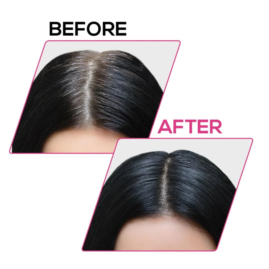 RENEE Cover-Up Hair Powder - Black | Covers Grey Roots & Bald Spots Instantly | Highly Pigmented, Fuller & Denser Look  4gm