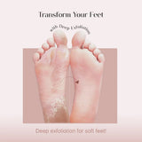 sumask-SeoulSkin Glycolic Acid Foot Peeling Mask (1 Pair), Korean Peeling & Exfoliating | Deep Exfoliation with Glycolic Acid, Removes Dead Skin, Cruelty-Free, Foot Peel Off Mask-Looknstyle