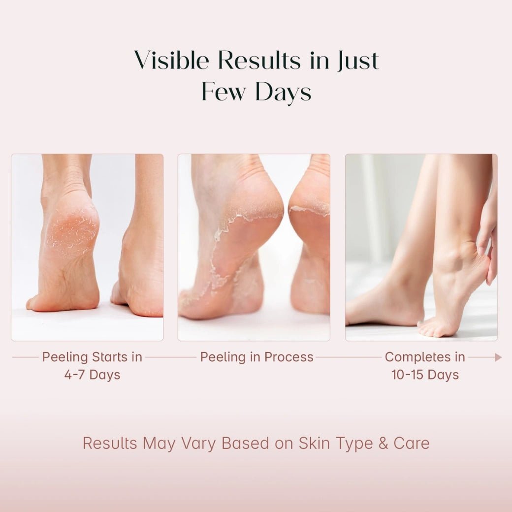 sumask-SeoulSkin Glycolic Acid Foot Peeling Mask (1 Pair), Korean Peeling & Exfoliating | Deep Exfoliation with Glycolic Acid, Removes Dead Skin, Cruelty-Free, Foot Peel Off Mask-Looknstyle