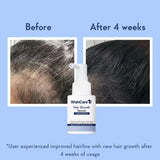 WISHCAREHAIRGROWTHSERUM20ML - WishCare Hair Growth Serum Concentrate - Resdensyl, Anagain, Caffeine, Biotin, Keratin & Rice Water 20ml - Looknstyle