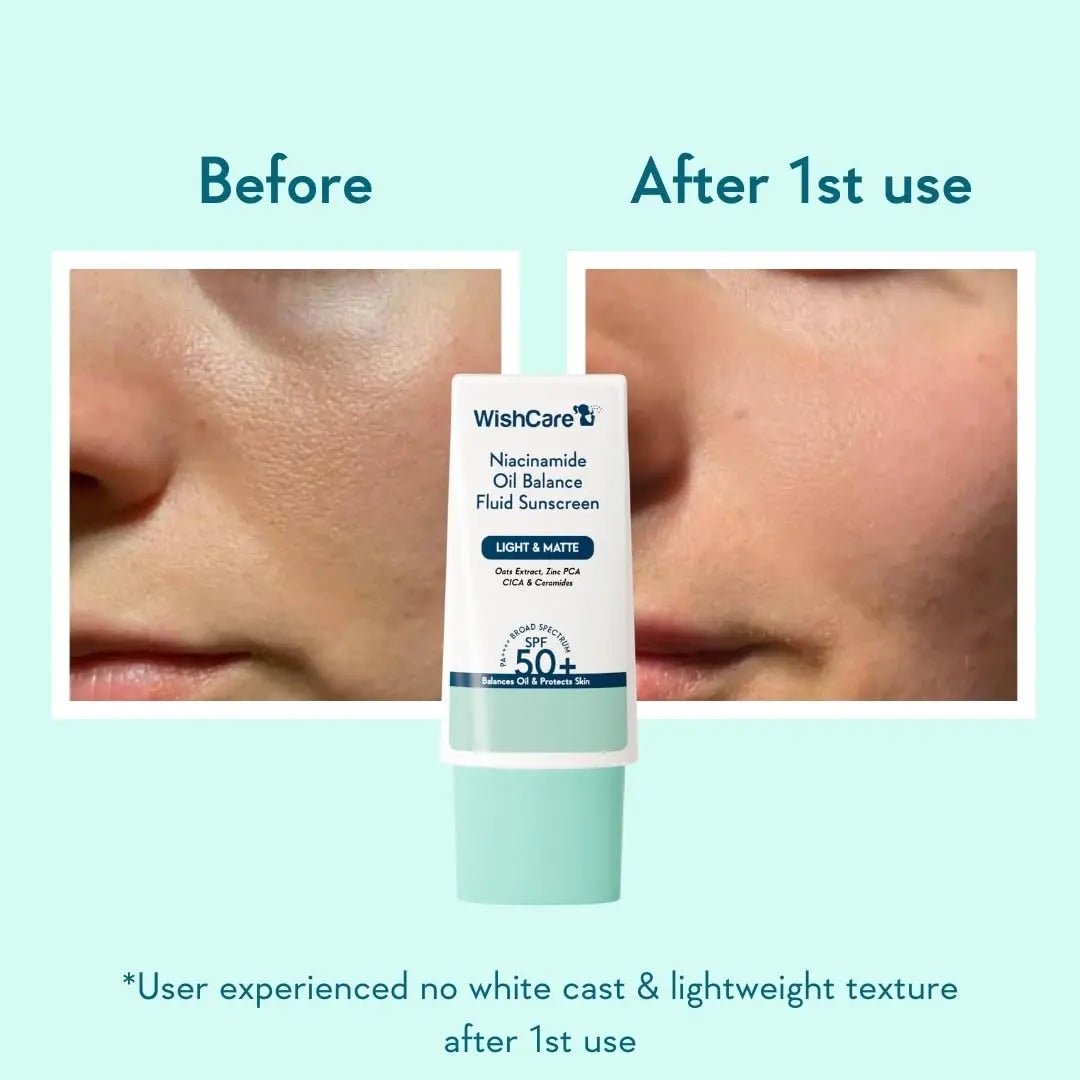 WISHCARENIACINAMIDEOILBALANCEFUILDSUNSCREEN - WishCare Niacinamide Oil Balance Fluid Sunscreen SPF 50 PA++++ In - Vivo Tested | 8Hrs+ SPF Protection | Lightweight, Matte & No White Cast | Sunscreen SPF 50 For Oily Skin, Sensitive, Dry & Combination Skin | For Women & Men | 30g - Looknstyle